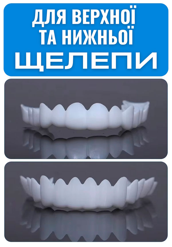Snap-On-Smile