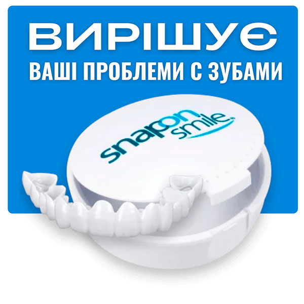 Snap-On-Smile